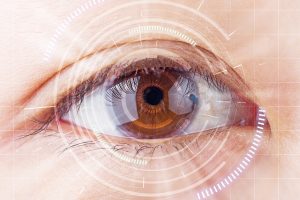augenlasern