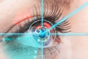 augenlaservip turkei