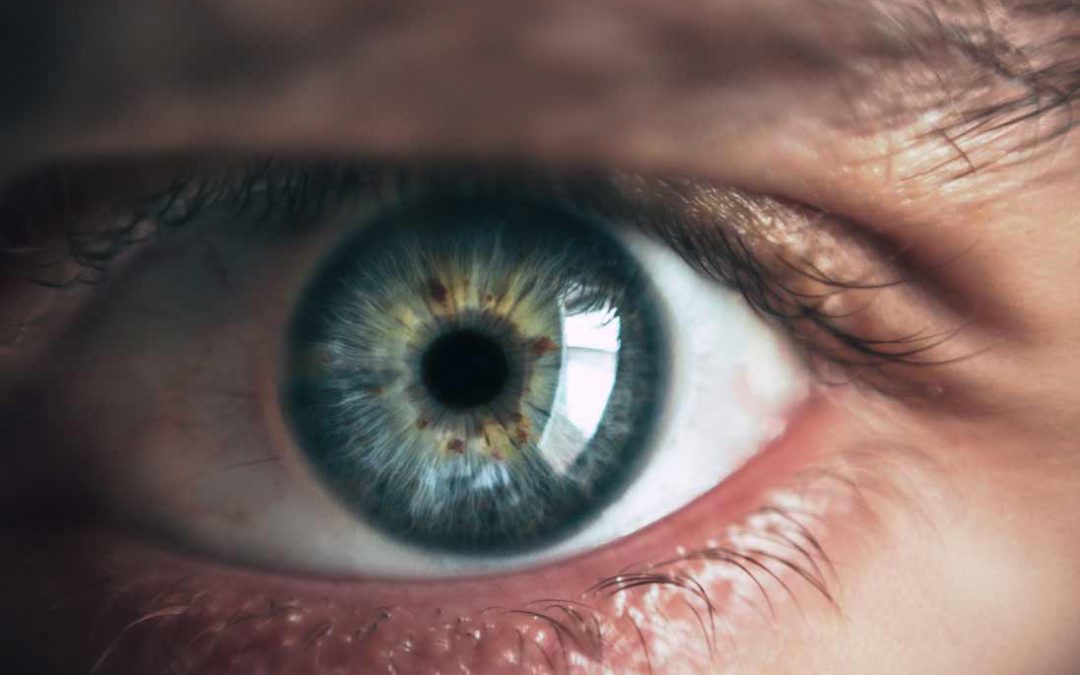 Augenlaser in der Türkei / in Istanbul