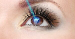 Augenlaserbehandlung in der Türkei (TransPRK - No Touch Laser)