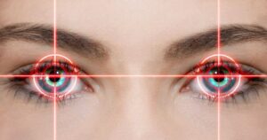Kurzsichtigkeit lasern ist möglich