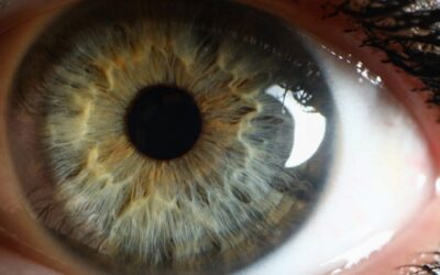 Augen Op Türkei